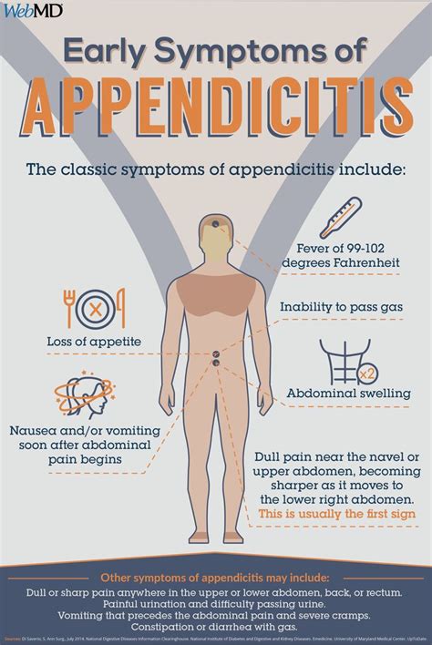 webmd appendicitis|webmd appendicitis symptoms.